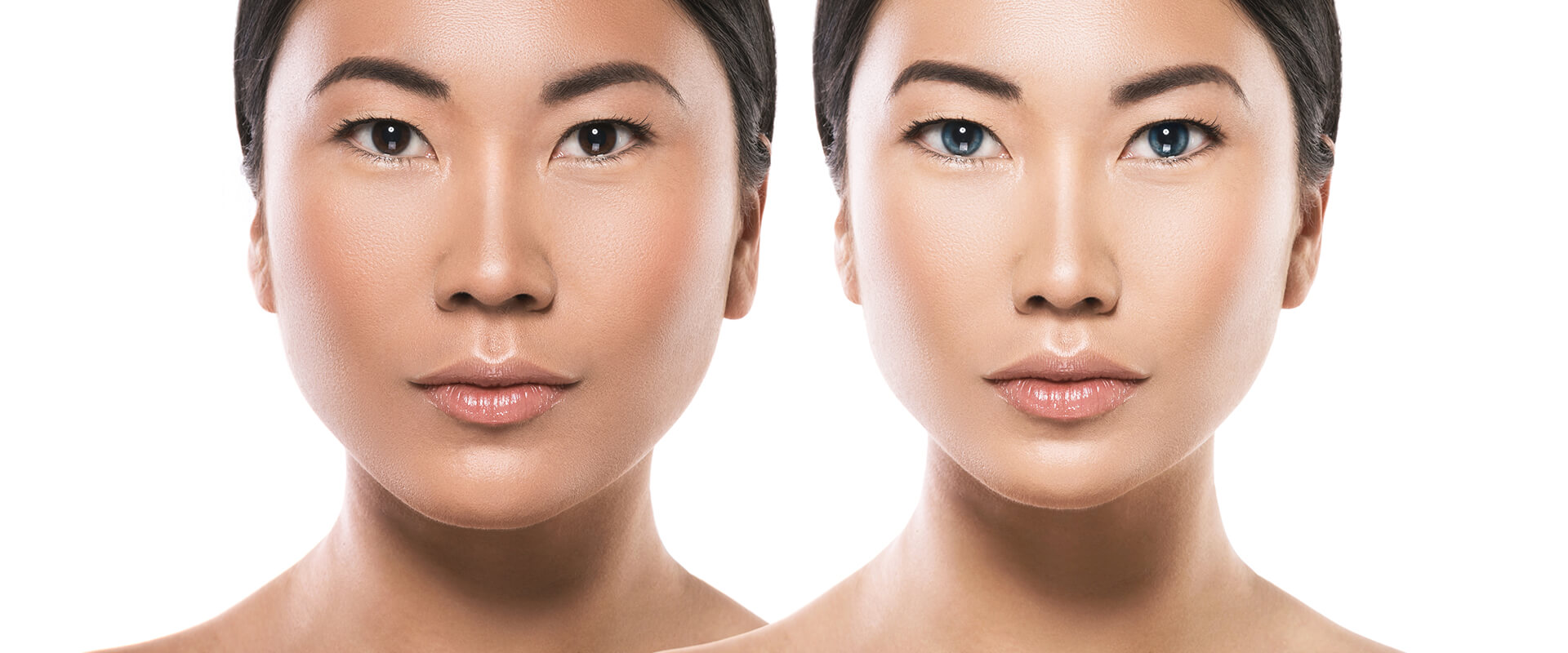 Facial Contouring (Orthognathic Surgery)